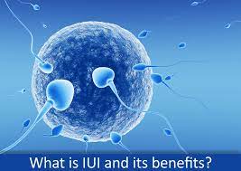 IUI – Intrauterine Insemination