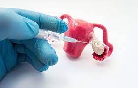 Ovulation Induction - Vansh IVF Centre
