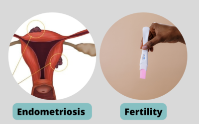 ENDOMETRIOSIS AND INFERTILTY