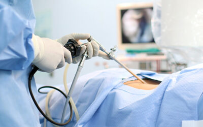 LAPAROSCOPIC SURGERY IN INFERTILITY